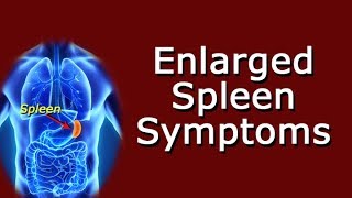 Enlarged Spleen Symptoms [upl. by Marutani]