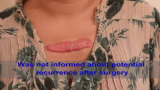 Chest Keloids  Mistakes to Avoid [upl. by Aicilaanna386]