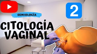 Cómo hacer una Citología 🤞 SEMIOLOGÍA 🏥 PARTE 2 💉💊 [upl. by Tubb954]