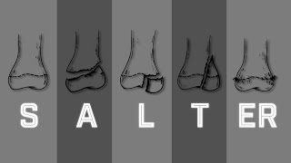 Salter Harris Fracture Classification  MEDZCOOL [upl. by Croix]