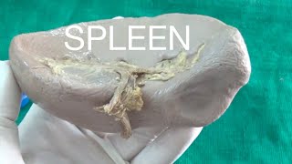 SPLEEN  Demonstration Anatomy [upl. by Llemaj970]