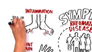 When Should I see a Rheumatologist [upl. by Tebasile]