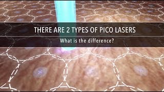 Why Are There Different Types of Pico Laser  Dr Kenneth Thean [upl. by Nnod]