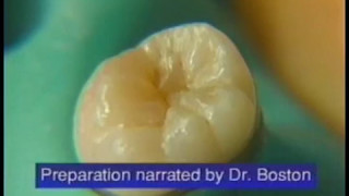 Fissurotomy®  How to Perform Minimally Invasive Fissure Exploration [upl. by Anned305]