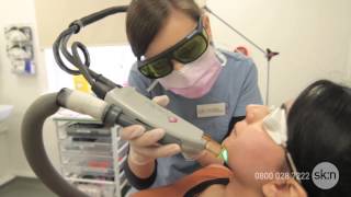 Laser Hair Removal  How does it work [upl. by Lash]